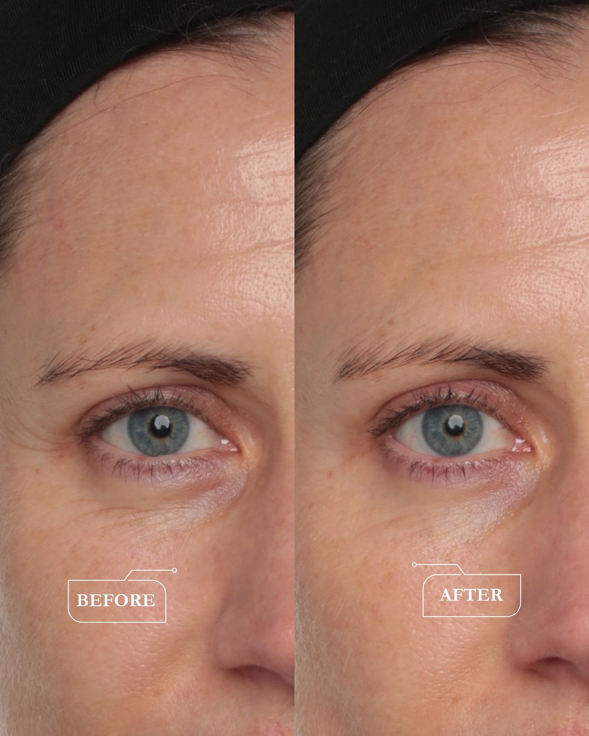 ABSOLUTE YOUTH EYE CREAM, дополнительное фото 2